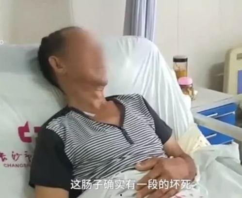 吃隔夜瓜导致小肠坏死,小肠坏死警示，食品安全需重视